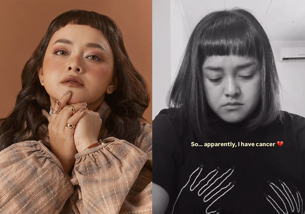 Lizzie Parra Ungkap Diagnosis Kanker, Sebut Datang Secara Mendadak